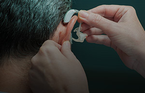 Hearing Aid and Cochlea implant Hearing Aid